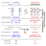 Absence of paresthesia during high-rate spinal cord stimulation reveals importance of synchrony for sensations evoked by electrical stimulation
